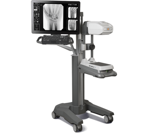 Orthoscan Mobile DI Orthoscan Mobile DI